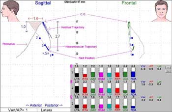 scan5-WEB patient scan of TMJ bite