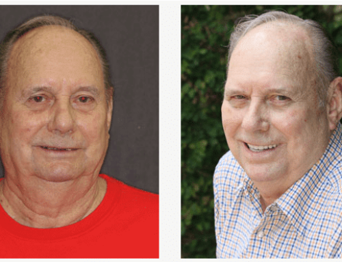 How You Can Get a Facelift Effect with Neuromuscular Dentures
