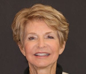 6 Female patient after a smile makeover