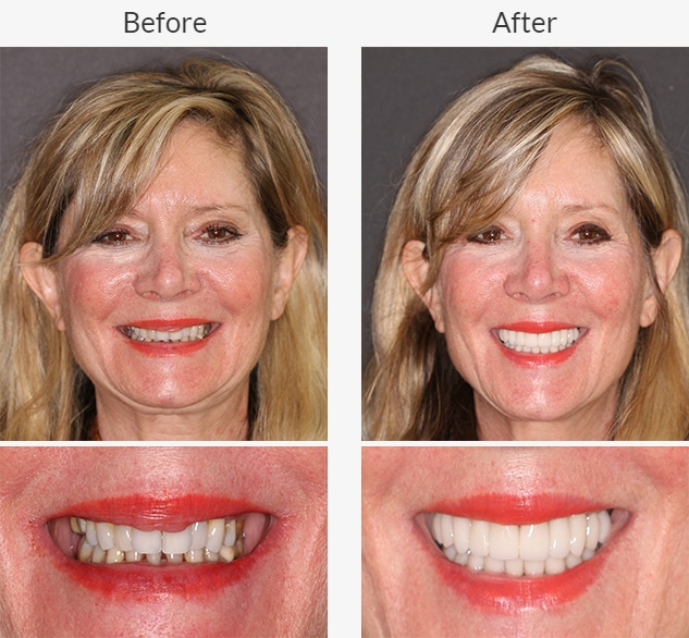 BellamyMurphy close up and portrait photos before and after dental treatment