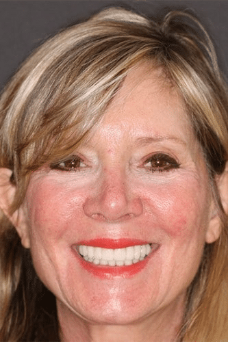 female dental patient of Beyond Exceptional Dentistry shows off her smile before working with the Savannah dentists