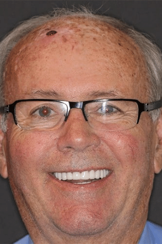 Male dental patient of Beyond Exceptional Dentistry