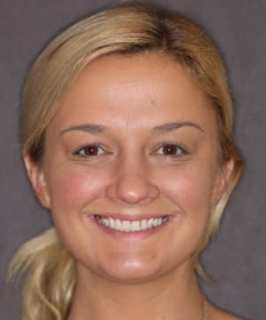 female dental patient of Beyond Exceptional Dentistry shows off her smile before working with the Savannah dentists female dental patient of Beyond Exceptional Dentistry shows off her smile before working with the Savannah dentists