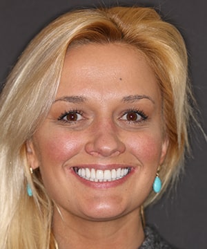 Pretty female patient of Dr. Rod Strickland showing off her amazing new smile. Pretty female patient of Dr. Rod Strickland showing off her amazing new smile.