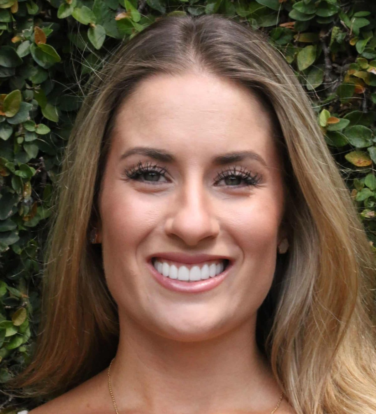 Smile Gallery Before & After Photos Savannah Dentist