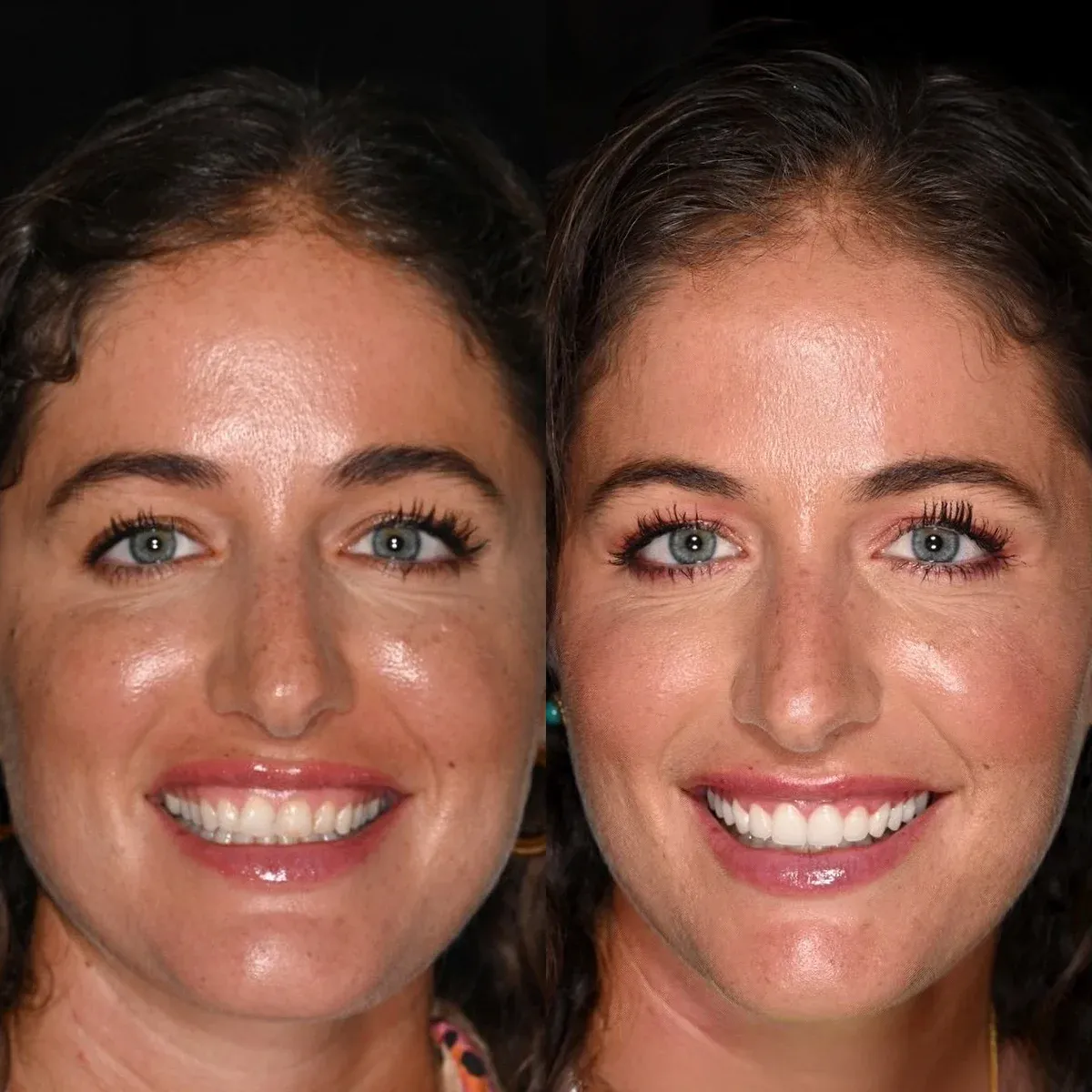 Before & After