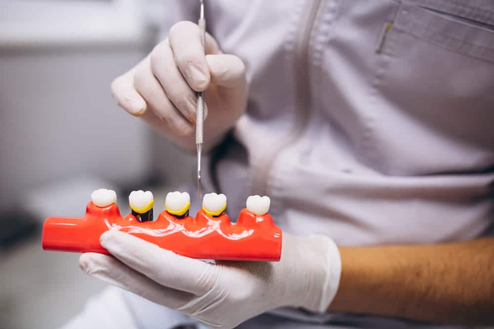 Dentist holding dental tool with dental model