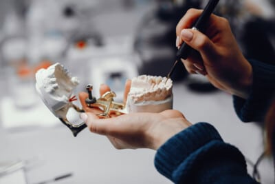 Dental model in dentist’s hand