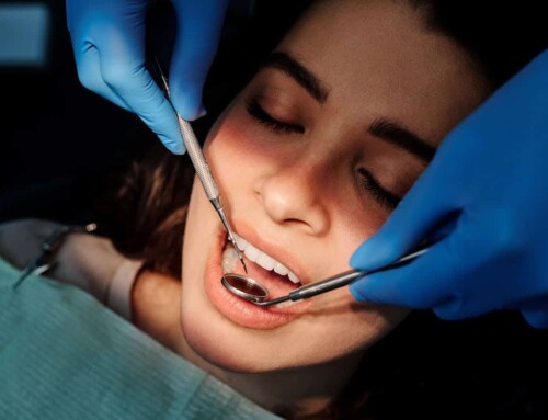 Can You Eat or Drive After Sedation Dentistry? 2025 Guide