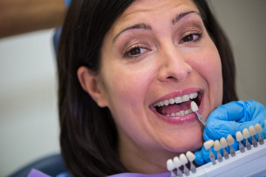 Dentist comparing tooth shades next to a patient’s smile