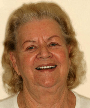 Margarete's smiling portrait after dental treatment